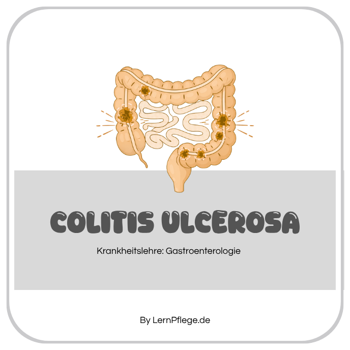 Colitis Ulcerosa