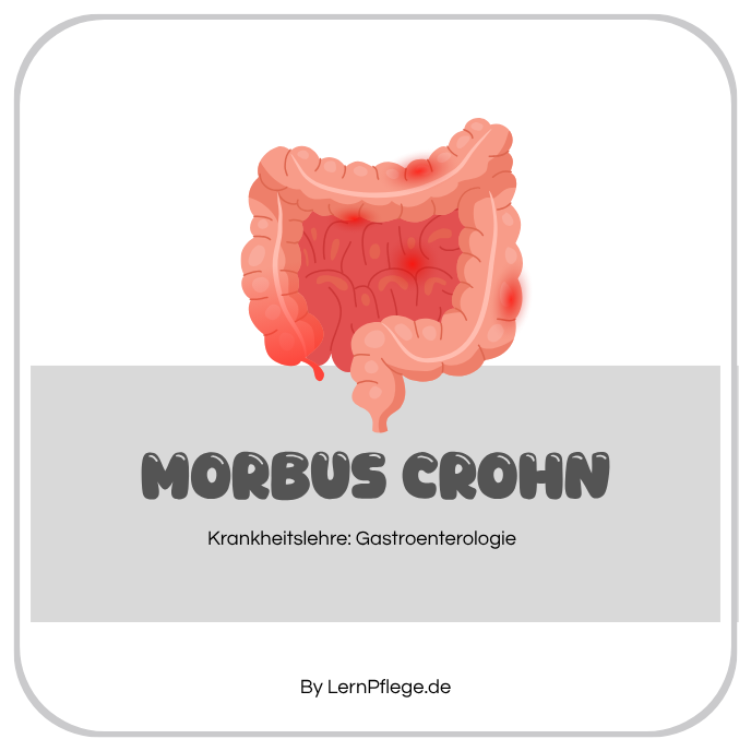 Morbus Crohn